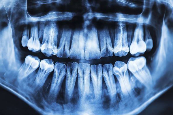 Radiologie et Imagerie Médicale – Radiographie panoramique dentaire pour un diagnostic précis des structures bucco-dentaires.