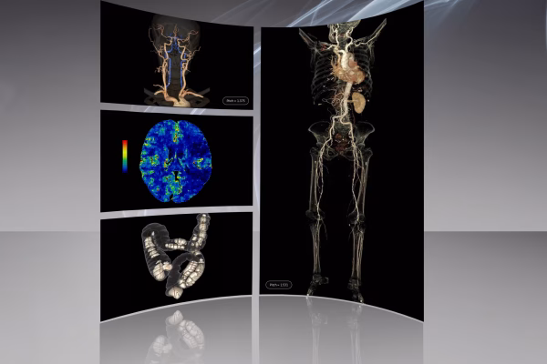 Scanner vitesse d’acquisition